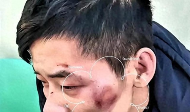KOK体育app下载-太猖狂！四川凌晨追打事件后续：6人一锅端，被查女子蛮横袭警