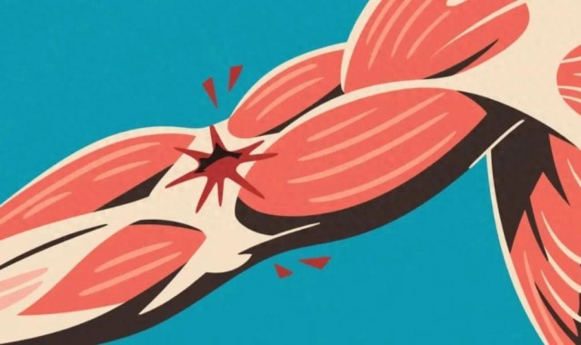警惕！小心这些药正在“溶解”你的肌肉